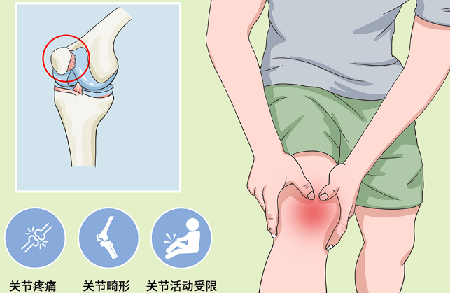 邵陽創傷骨科,邵陽風濕病區,邵陽骨質增生,邵陽關節病區,邵陽頸椎病區
