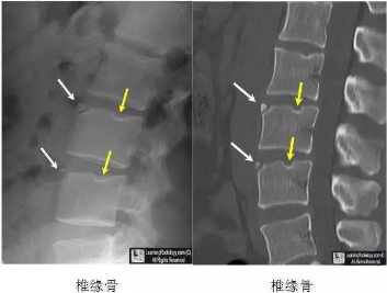 邵陽創傷骨科,邵陽風濕病區,邵陽骨質增生,邵陽關節病區,邵陽頸椎病區