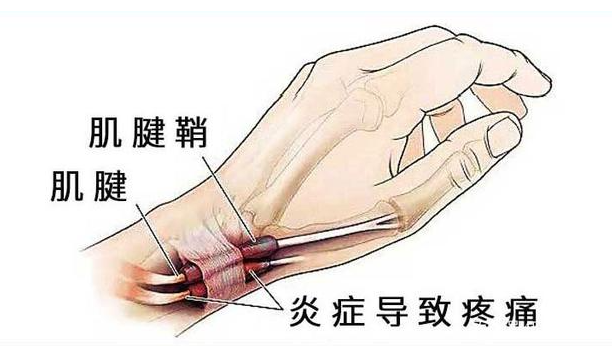 邵陽創傷骨科,邵陽風濕病區,邵陽骨質增生,邵陽關節病區,邵陽頸椎病區