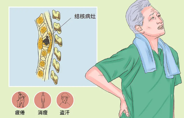 邵陽創傷骨科,邵陽風濕病區,邵陽骨質增生,邵陽關節病區,邵陽頸椎病區