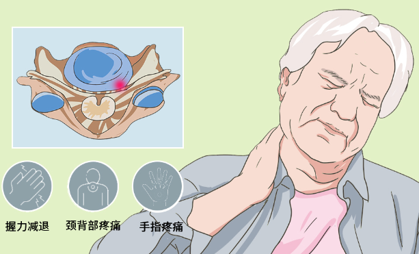 邵陽創傷骨科,邵陽風濕病區,邵陽骨質增生,邵陽關節病區,邵陽頸椎病區