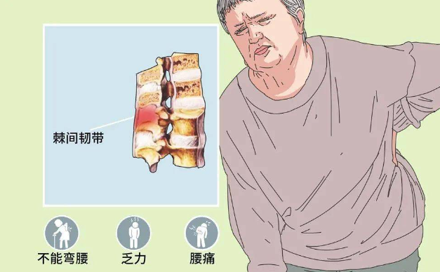 邵陽創傷骨科,邵陽風濕病區,邵陽骨質增生,邵陽關節病區,邵陽頸椎病區