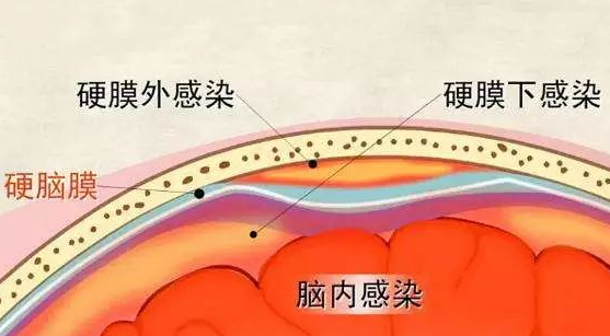 邵陽創傷骨科,邵陽風濕病區,邵陽骨質增生,邵陽關節病區,邵陽頸椎病區