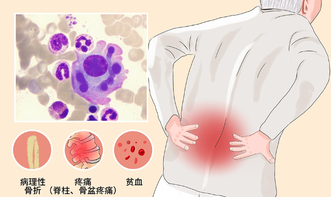 邵陽創傷骨科,邵陽風濕病區,邵陽骨質增生,邵陽關節病區,邵陽頸椎病區